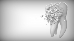 Foto de Promoción de verano en implantes con corona