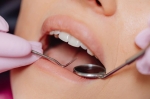 Foto de Por qué elegir la Clínica Dental Pérez Ballesteros para tus tratamientos de odontología estética en Salamanca