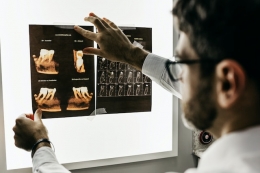 Salud bucodental y el Alzheimer
