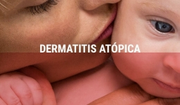 Crece por tres la incidencia de dermatitis atópica en España