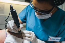 Turquía se encuentra entre el top 10 mundial de turismo médico gracias al trasplante capilar