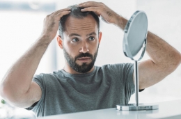 Cómo conseguí un injerto de pelo económico y eficaz en España