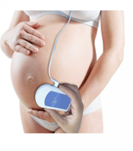 Uso apropiado del doppler fetal casero