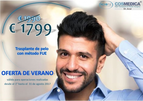 5 Razones para someterse a un trasplante de pelo en Turquia