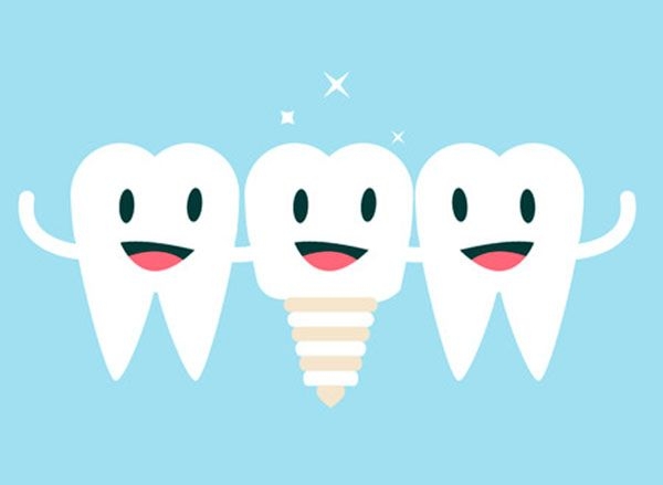 Acertar con una clínica de implantes dentales en Madrid es posible