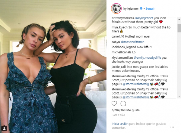 Secretos para mejorar el aspecto de los labios sin acabar como Kylie Jenner, por el Dr. Pierre Nicolau