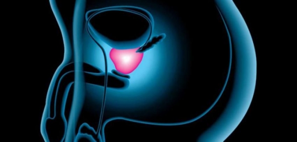 Síntomas del cáncer de próstata, informa IU Málaga