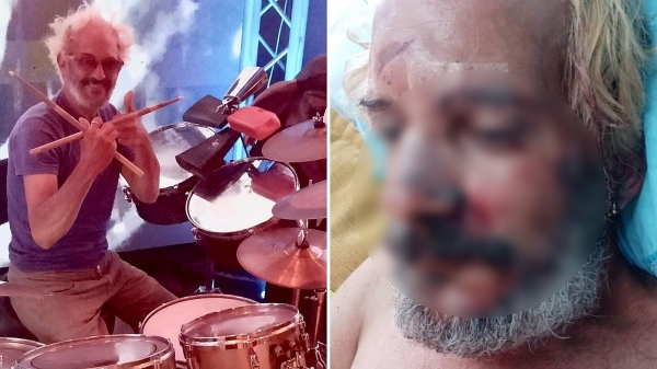 Denuncian violento asalto contra músico cubano en La Habana