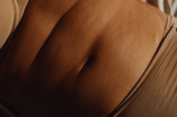 ¿Cómo prepararte para una abdominoplastia?