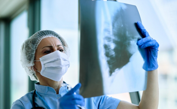 Consulta de Neumología Privada del Dr. Alberto Caballero en Granada: Atención Especializada para la Salud Respiratoria