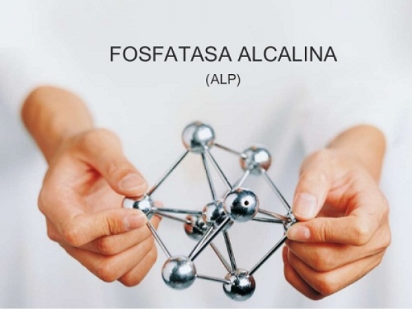 ¿Por qué es necesario realizar un análisis de  fosfatasa alcalina?