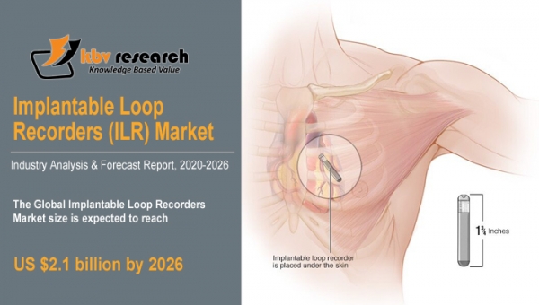Implantable Loop Recorders Market Size Worth $2.1 Billion By 2026 - KBV Research