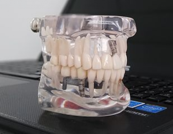 El desgaste y pérdida de los dientes