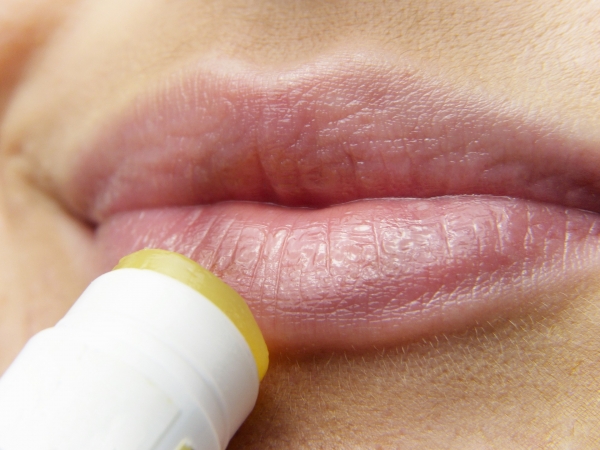 Como curar el herpes simple