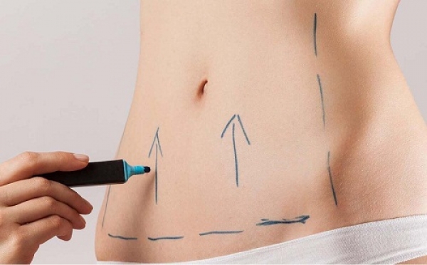Qué hacer antes de someterte a una abdominoplastia