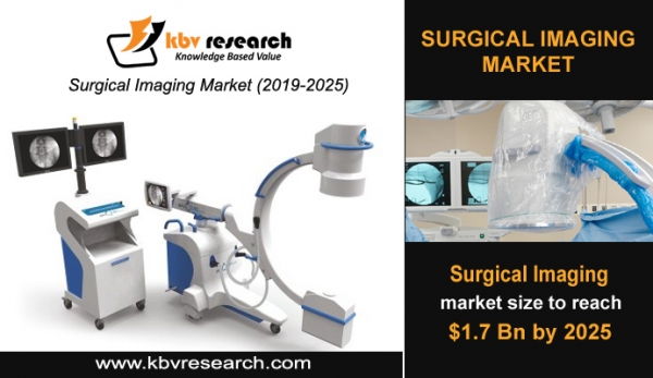 Global Surgical Imaging Market to reach a market size of $1.7 billion by 2025- KBV Research